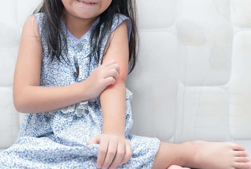 Identifying and Responding to Allergic Reactions in Children