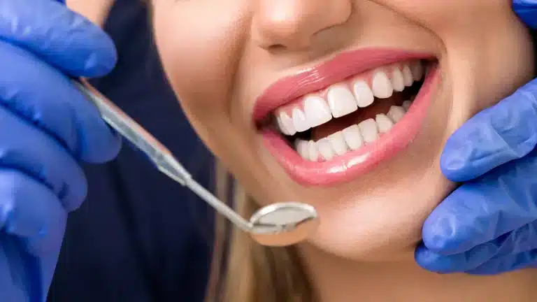 The Ultimate Guide to Dental Scale and Clean for a Healthier, Happier Smile