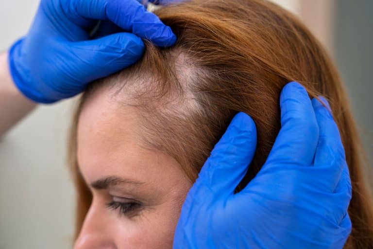 The Indian Hair Care Brands Redefining Hair Loss Treatment